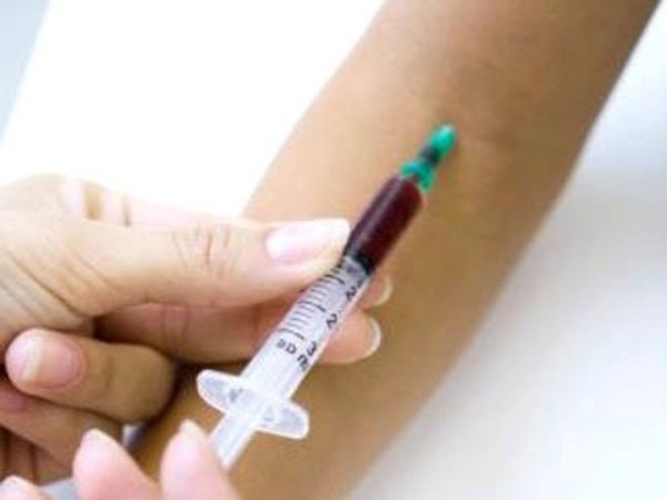 Thử máu có thể phát hiện 86% ung thư buồng trứng ảnh 1 Thử máu có thể phát hiện 86% ung thư buồng trứng ảnh 1