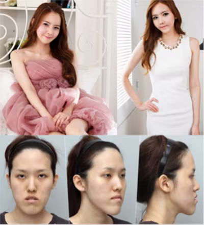 Choáng với tài "dao kéo" của ê kíp bác sĩ Let Me In vừa sang Việt Nam ảnh 6