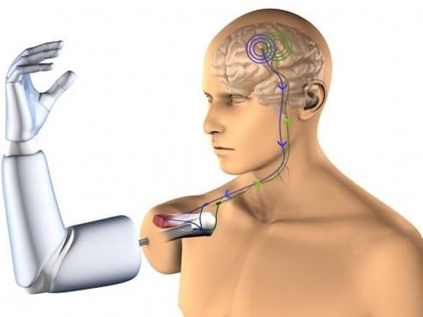 Nghiên cứu thành công cánh tay robot cho người liệt toàn thân. ảnh 1 Nghiên cứu thành công cánh tay robot cho người liệt toàn thân. ảnh 1
