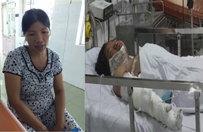 Xót xa hoàn cảnh của bé gái bị mẹ tẩm xăng đốt  ảnh 1