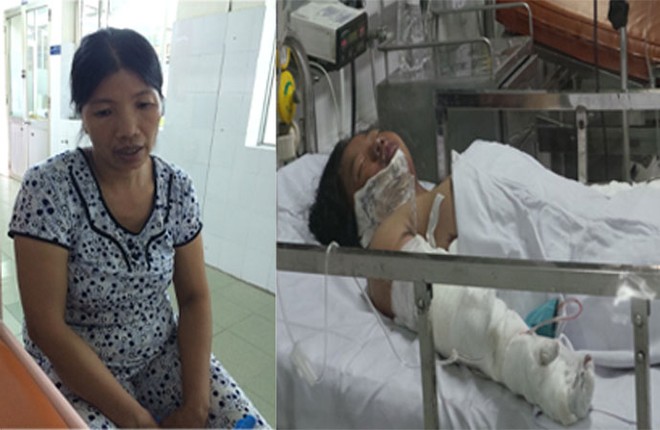Xót xa hoàn cảnh của bé gái bị mẹ tẩm xăng đốt ảnh 1 Xót xa hoàn cảnh của bé gái bị mẹ tẩm xăng đốt ảnh 1