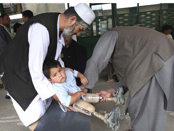 "Nỗi đau bom mìn" ở Afghanistan ảnh 1 "Nỗi đau bom mìn" ở Afghanistan ảnh 1