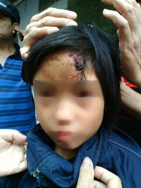 Chưa thể khẳng định cháu bé nhốt trong chùa bị đánh ảnh 1 Chưa thể khẳng định cháu bé nhốt trong chùa bị đánh ảnh 1