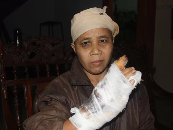 Nghịch tử đánh mẹ kế, chém cha nhập viện ảnh 1 Nghịch tử đánh mẹ kế, chém cha nhập viện ảnh 1