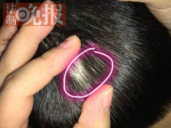 Bắt 4 giáo viên dùng kim đâm trẻ ảnh 1 Bắt 4 giáo viên dùng kim đâm trẻ ảnh 1