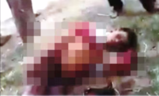 Lái xe ôm nghi bị cướp đâm trọng thương cố lết ra đường kêu cứu ảnh 1 Lái xe ôm nghi bị cướp đâm trọng thương cố lết ra đường kêu cứu ảnh 1