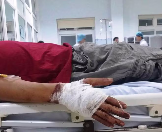 Chém gần đứt lìa tay đối thủ vì mâu thuẫn trong việc tranh giành khách ảnh 1