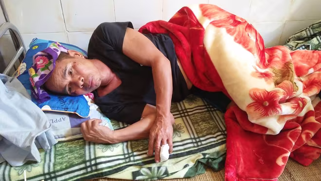 Hi hữu: Người đàn ông bị lợn rừng cắn đứt ngón tay ảnh 1 Hi hữu: Người đàn ông bị lợn rừng cắn đứt ngón tay ảnh 1