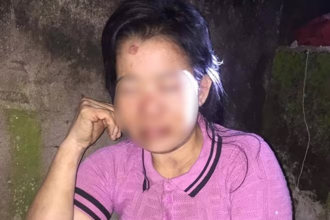 Làm rõ nghi vấn người phụ nữ bị hành hung dã man ảnh 1 Làm rõ nghi vấn người phụ nữ bị hành hung dã man ảnh 1