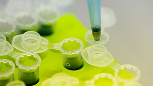 Phát hiện virus gây suy giảm nhận thức sống trong cổ họng người ảnh 4 Phát hiện virus gây suy giảm nhận thức sống trong cổ họng người ảnh 4