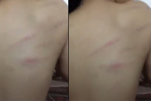 Những vụ giáo viên hành xử dị thường, phạt học trò theo kiểu "không thể nghĩ ra" ảnh 3 Những vụ giáo viên hành xử dị thường, phạt học trò theo kiểu "không thể nghĩ ra" ảnh 3
