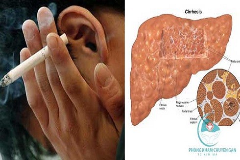 Thuốc lá nguy hiểm…tại sao vẫn coi thường? ảnh 3 Thuốc lá nguy hiểm…tại sao vẫn coi thường? ảnh 3