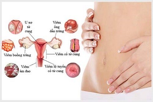 Dung dịch chọn thai nhi: Tiềm ẩn nhiều nguy cơ khôn lường ảnh 2 Dung dịch chọn thai nhi: Tiềm ẩn nhiều nguy cơ khôn lường ảnh 2