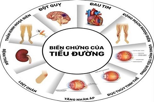 Cứ 6 giây 1 người chết: Bệnh tiểu đường nguy hiểm như thế nào? ảnh 1 Cứ 6 giây 1 người chết: Bệnh tiểu đường nguy hiểm như thế nào? ảnh 1