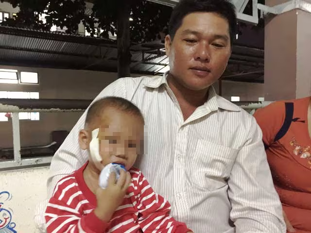 Bé trai 3 tuổi bị cây đâm xuyên mặt được cứu sống kịp thời ảnh 1 Bé trai 3 tuổi bị cây đâm xuyên mặt được cứu sống kịp thời ảnh 1