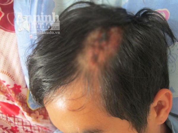 Lái, phụ xe "giường nằm cao cấp" đón tiếp khách bằng...tuýp sắt, búa đinh ảnh 2 Lái, phụ xe "giường nằm cao cấp" đón tiếp khách bằng...tuýp sắt, búa đinh ảnh 2