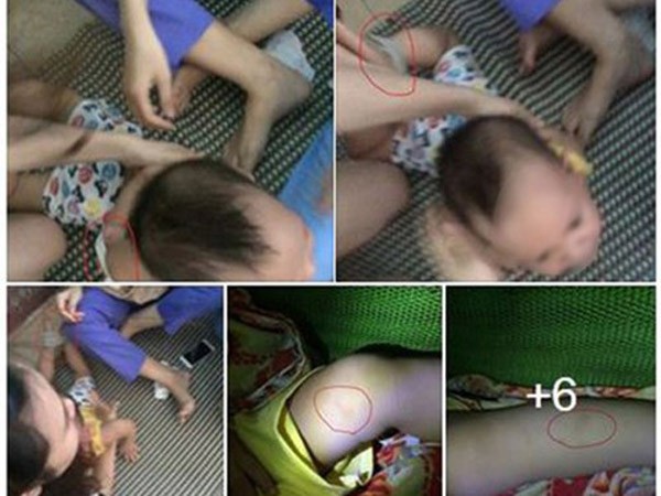 Khởi tố 2 giáo viên bạo hành bé trai 14 tháng tuổi ảnh 1 Khởi tố 2 giáo viên bạo hành bé trai 14 tháng tuổi ảnh 1
