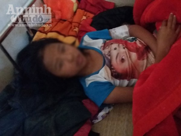 Bắt hai thanh niên dùng dao đâm nữ sinh lớp 7 ảnh 1 Bắt hai thanh niên dùng dao đâm nữ sinh lớp 7 ảnh 1