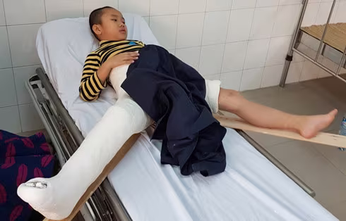 Vụ học sinh gãy chân ở trường Nam Trung Yên: Khi sự dối trá lên ngôi ảnh 2 Vụ học sinh gãy chân ở trường Nam Trung Yên: Khi sự dối trá lên ngôi ảnh 2