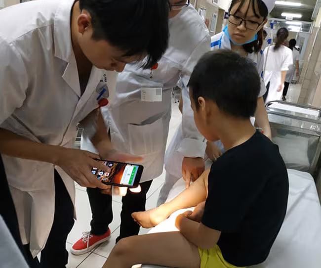 Đang chơi ở công viên cạnh chung cư, cháu bé bất ngờ bị rắn cắn ảnh 1