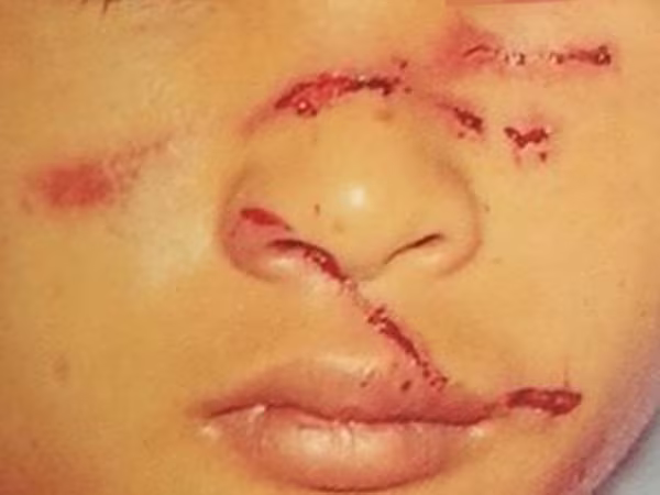 Để lạc mất trâu, con trai bị bố đánh dã man ảnh 1 Để lạc mất trâu, con trai bị bố đánh dã man ảnh 1