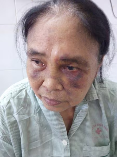 Mâu thuẫn với chồng, vợ dẫn người đánh mẹ chồng chấn thương sọ não ảnh 1 Mâu thuẫn với chồng, vợ dẫn người đánh mẹ chồng chấn thương sọ não ảnh 1
