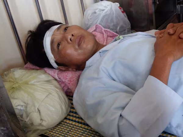 Nhắc nhở nhóm thanh niên bắt trộm cá, công an xã bị chém trọng thương ảnh 1