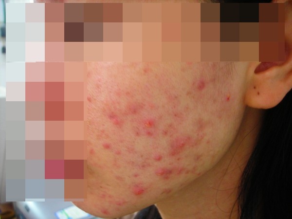 Chất bảo quản: "Sát thủ giấu mặt" trong những sản phẩm làm đẹp ảnh 2 Chất bảo quản: "Sát thủ giấu mặt" trong những sản phẩm làm đẹp ảnh 2
