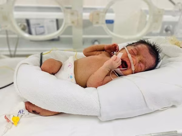 Bé sinh non bị bỏ rơi bên đường, tính mạng nguy kịch được bác sĩ cứu sống ảnh 1 Bé sinh non bị bỏ rơi bên đường, tính mạng nguy kịch được bác sĩ cứu sống ảnh 1
