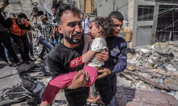 Một bé gái Palestine bị thương sau cuộc không kích của Israel vào dải Gaza Một bé gái Palestine bị thương sau cuộc không kích của Israel vào dải Gaza