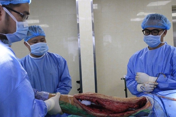 Người đàn ông đi lại được sau cuộc đại phẫu hiếm có trên thế giới ảnh 2