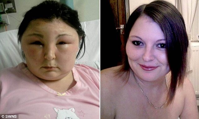 Tự nhuộm tóc khiến mắt bị mù và mặt bị biến dạng hoàn toàn ảnh 1 Tự nhuộm tóc khiến mắt bị mù và mặt bị biến dạng hoàn toàn ảnh 1