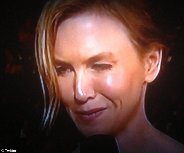Nghi án Renee Zellweger lạm dụng botox ảnh 3 Nghi án Renee Zellweger lạm dụng botox ảnh 3