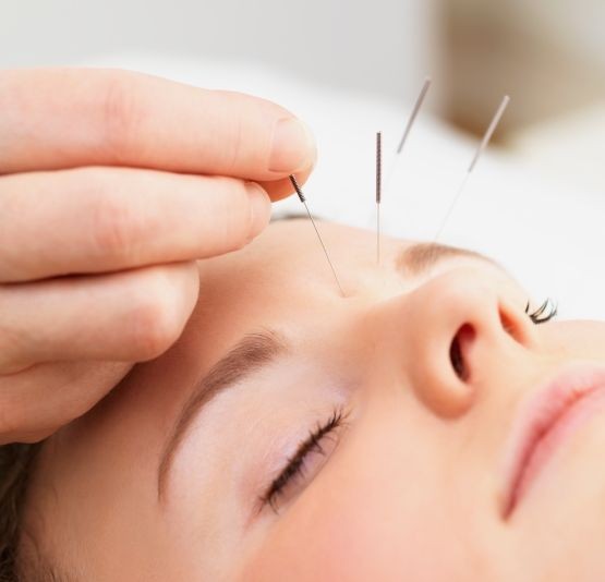 Thụy Sĩ: 16 người nhiễm HIV vì châm cứu ảnh 1 Thụy Sĩ: 16 người nhiễm HIV vì châm cứu ảnh 1