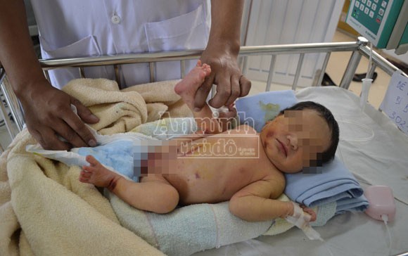 Bé gái 10 ngày tuổi bị bỏ rơi ở bụi tre, dòi, kiến bâu đầy người ảnh 1 Bé gái 10 ngày tuổi bị bỏ rơi ở bụi tre, dòi, kiến bâu đầy người ảnh 1