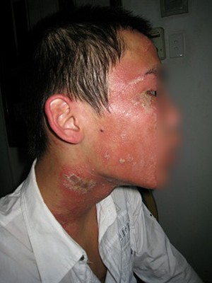 Kỳ 1: Dung nhan biến dạng vì dược phẩm tự chế ảnh 2 Kỳ 1: Dung nhan biến dạng vì dược phẩm tự chế ảnh 2
