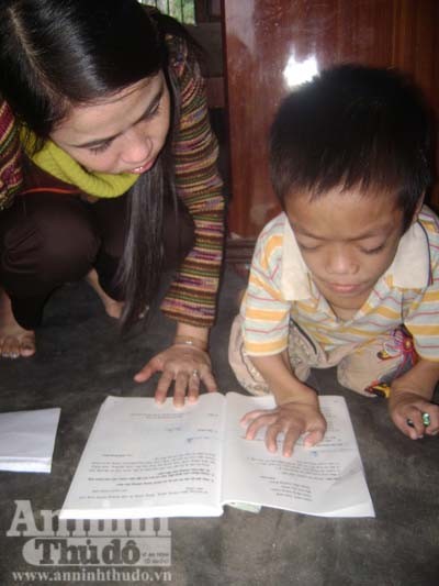 Nghị lực phi thường của “anh em tí hon” ảnh 4 Nghị lực phi thường của “anh em tí hon” ảnh 4