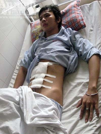 Một thanh niên bị côn đồ đâm thủng bụng ảnh 1 Một thanh niên bị côn đồ đâm thủng bụng ảnh 1