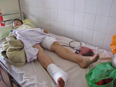 Sập gác ở lớp học thêm, 2 học sinh bị thương nặng ảnh 1 Sập gác ở lớp học thêm, 2 học sinh bị thương nặng ảnh 1