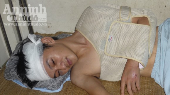 Giả danh công an đi cướp tài sản ảnh 1 Giả danh công an đi cướp tài sản ảnh 1