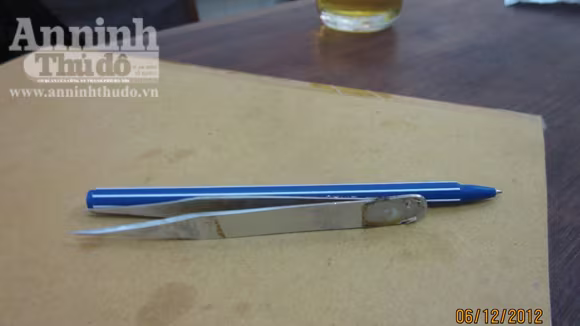 Nam thanh niên nuốt kẹp sắt dài 12cm vào bụng ảnh 2 Nam thanh niên nuốt kẹp sắt dài 12cm vào bụng ảnh 2