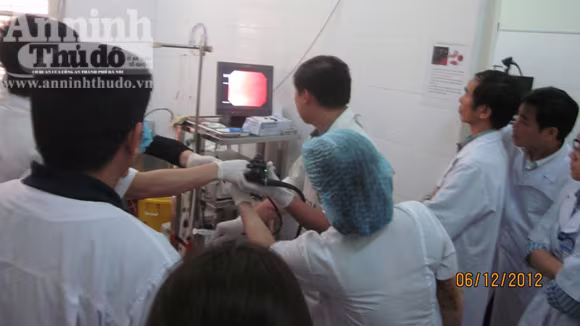 Cụ bà 77 tuổi bị dị vật "kết tinh" dài 6 cm mắc trong tá tràng ảnh 1 Cụ bà 77 tuổi bị dị vật "kết tinh" dài 6 cm mắc trong tá tràng ảnh 1