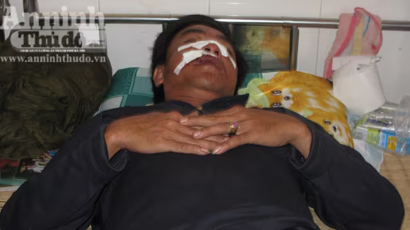 Bị chặn xe, lâm tặc trút gỗ, tấn công kiểm lâm ảnh 1 Bị chặn xe, lâm tặc trút gỗ, tấn công kiểm lâm ảnh 1