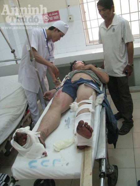 Xe bồn "đấu đầu" với xe khách, hàng chục hành khách hoảng loạn ảnh 8 Xe bồn "đấu đầu" với xe khách, hàng chục hành khách hoảng loạn ảnh 8