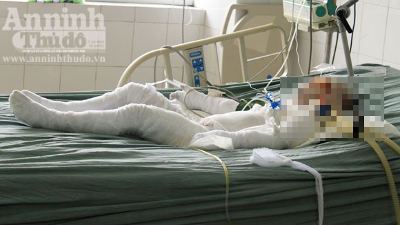 Vụ án tưới xăng, phóng hỏa ở Hải Phòng: Nạn nhân thứ 3 tử vong ảnh 1 Vụ án tưới xăng, phóng hỏa ở Hải Phòng: Nạn nhân thứ 3 tử vong ảnh 1