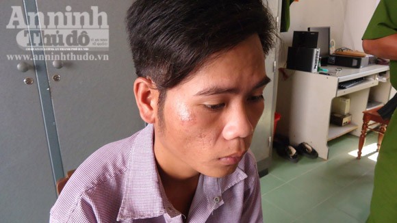 Rượu say, giở trò đồi bại với cô gái bị đao bẩm sinh ảnh 1 Rượu say, giở trò đồi bại với cô gái bị đao bẩm sinh ảnh 1