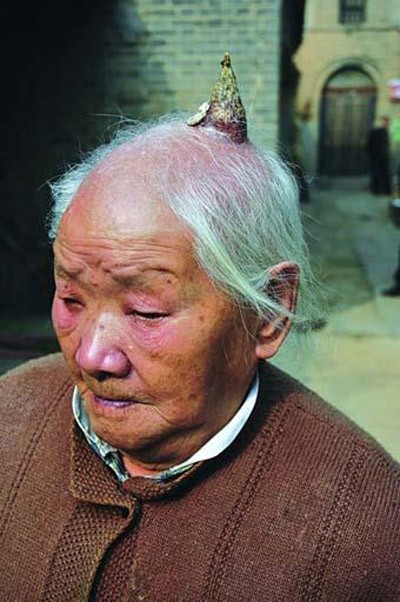 "Bí ẩn" những chiếc sừng mọc trên...đầu người ảnh 2 "Bí ẩn" những chiếc sừng mọc trên...đầu người ảnh 2