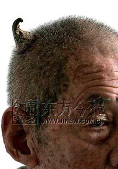 "Bí ẩn" những chiếc sừng mọc trên...đầu người ảnh 1 "Bí ẩn" những chiếc sừng mọc trên...đầu người ảnh 1