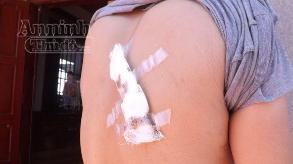 Nữ sinh bị người yêu cũ “bắt cóc” sau ngày thi tốt nghiệp đầu tiên ảnh 2 Nữ sinh bị người yêu cũ “bắt cóc” sau ngày thi tốt nghiệp đầu tiên ảnh 2