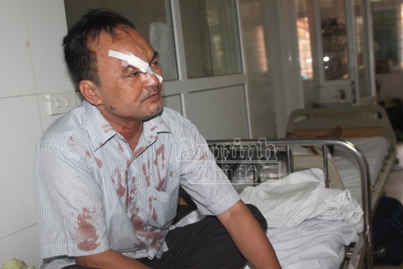 Giây phút kinh hoàng của các hành khách trên chuyến xe bị nạn ảnh 1 Giây phút kinh hoàng của các hành khách trên chuyến xe bị nạn ảnh 1